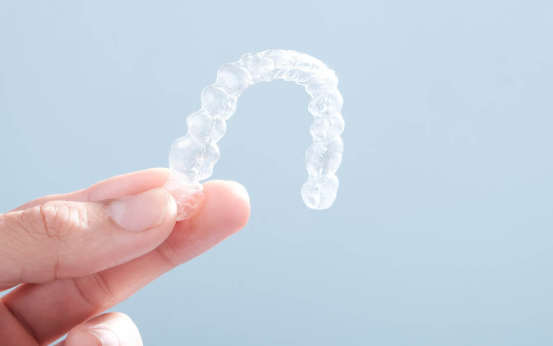 How Does Invisalign Work? 8 Things to Know About the Invisalign Process