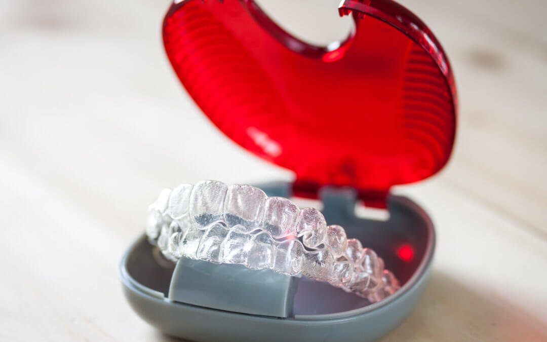 how to get invisalign