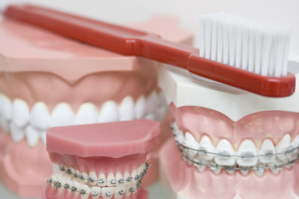 4 Reasons Phase 1 Orthodontics Treatment for Children Is Important
